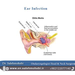 ear infection | ear infection symptoms | ear infection treatment