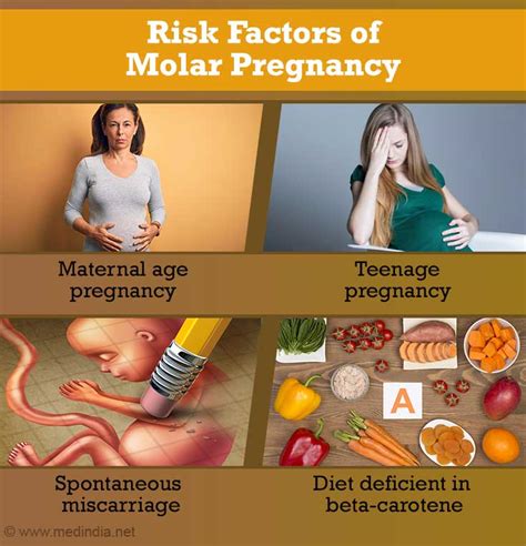 Molar Pregnancy Hydatidiform Mole Causes Symptoms Diagnosis