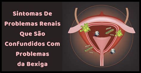 Infecção Na Bexiga O Que É Sintomas Causas E Tratamento Tua Saúde