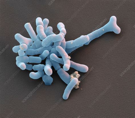 Bifidobacterium bacteria, SEM - Stock Image - C035/7894 - Science Photo ...