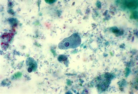 Public Domain Picture Entamoeba Histolytica Trophozoite Showing Atypical Nucleus With Its