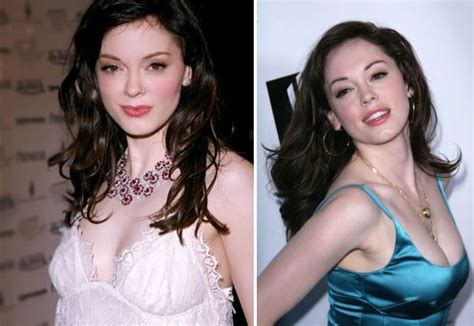 Rose McGowan Plastic Surgery Before And After Photos