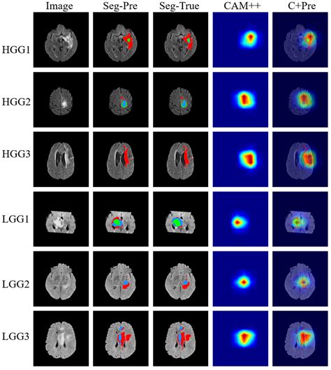 Applied Sciences Free Full Text An Explainable Brain Tumor Detection Framework For Mri Analysis