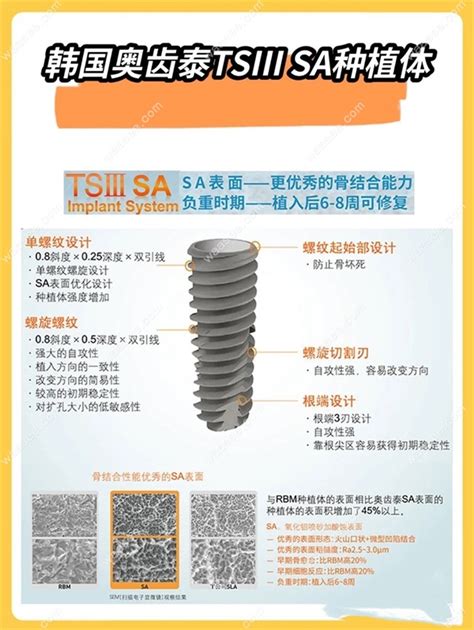 奥齿泰全口种植牙价格多少参考上海深圳广州等地价格 口腔资讯 牙齿矫正网