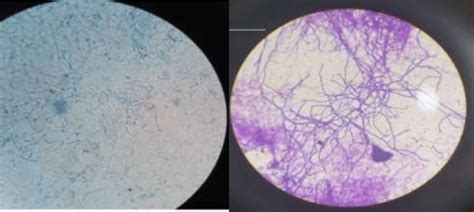 Slide Of A Streptomyces Spp Hyphae Grown On Isp2 Agar Left And On