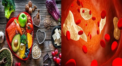 High Cholesterol Level Have This Food To Reduce Cholesterol In Seven Days