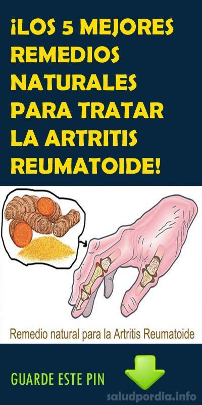 ¡los 5 Mejores Remedios Naturales Para Tratar La Artritis Reumatoide