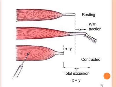 Indications And Principles Of Tendon Transfer Ppt