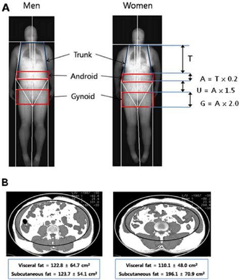 Regional Body Composition Measurement By DXA A And CT B