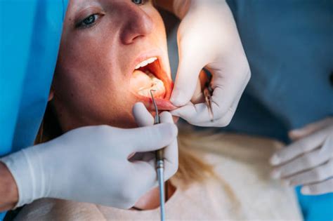 En qué consiste un curetaje Clínica dental Gil