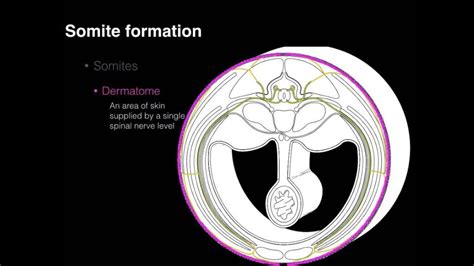 Embryologic Sclerotome Vs Dermatome Patterns - Dermatomes Chart and Map