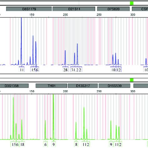 PDF Importance Of Y STR Profiling In Sexual Assault Cases With Mixed