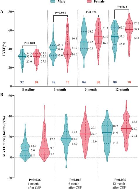 Sex Differences Outcomes In Conduction System Pacing For Patients With Typical Left Bundle