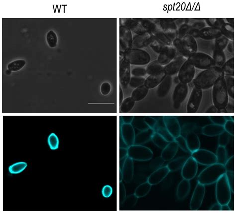 Calcofluor White Staining Of The Wild Type And Spt20dd Calcofluor Download Scientific Diagram