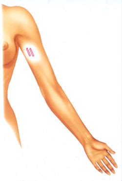 Poderosas Falando Sério: Métodos contraceptivos: Métodos ... 