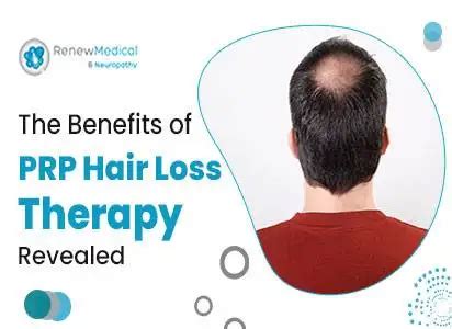 The Benefits Of Prp Hair Loss Therapy Revealed