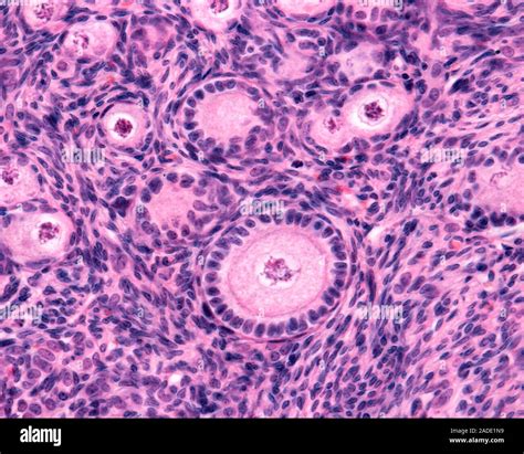 Micrografía de luz de la corteza ovárica mostrando varios folículos