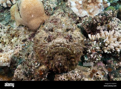 Stonefish Sting