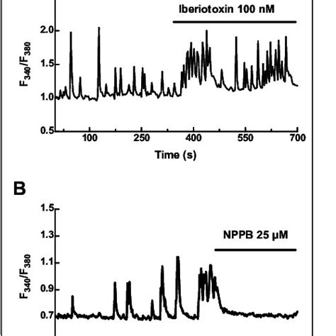 Ca 2 Oscillations Of Detrusor Cells Are Modulated By Ca 2 Activated