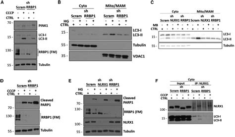 Mitochondrial Protein Import Stress Regulates The Lc3 Lipidation Step