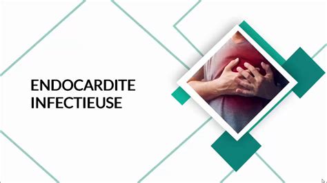 Cardiopathe Et Soins Dentaire Endocardite Infectieuse Prise En Charge Dentist Cardiology