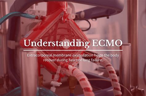 Understanding Ecmo Division Of Cardiothoracic Surgery Washington