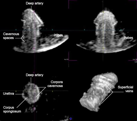 Erecting Penis 3d And 4d Imaging Ucl