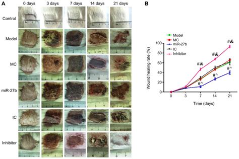 Downregulation Of Mir B Promotes Skin Wound Healing In A Rat Model Of