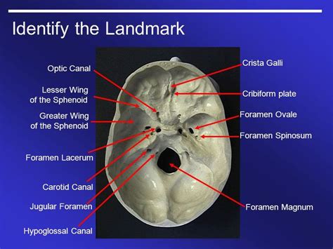 Résultats De Recherche D Images Pour Hypoglossal Canal Jugular Magnum Head And Neck