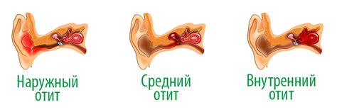Отит - симптомы и лечение у взрослых и детей