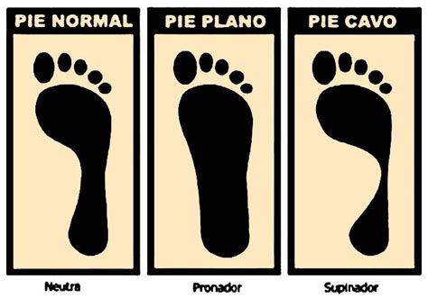 Espacios Plurales Causas Ejercicios Y Problemas De Los Pies Planos Y Pies Cavo