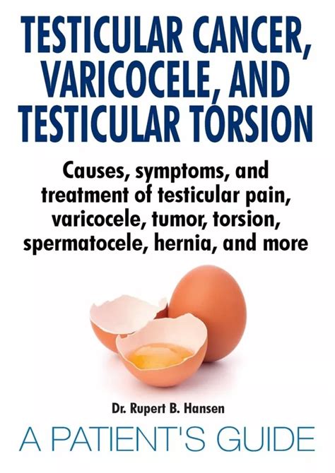 Ppt [pdf] Download Testicular Cancer Varicocele And Testicular