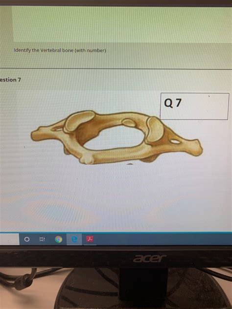 Solved Question 6 Acer Identify The Vertebral Bone With Chegg