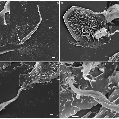 Trypanosoma Cruzi Can Enters Into Host Cells Both By Anterior And Download Scientific Diagram