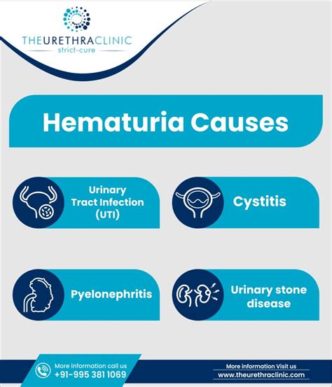 Hematuria Treatment: Effective Care for Blood in Urine