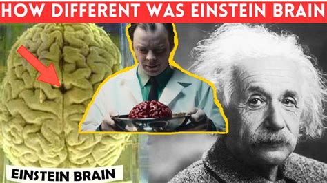 The Tragic Story Of How Einsteins Brain Was Stolen How Different Was