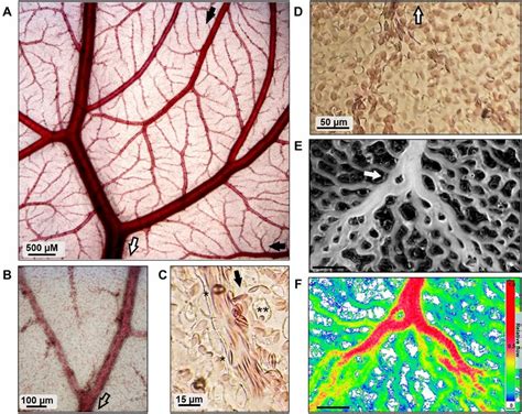 Imaging Of The Microvascular Network Of The Chick Chorioallantoic