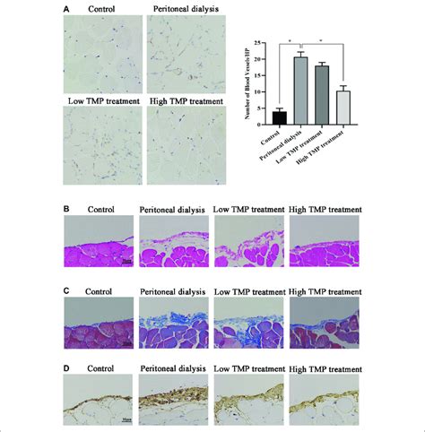 Effect Of TMP On Peritoneal Angiogenesis And Fibrosis In PD Mouse