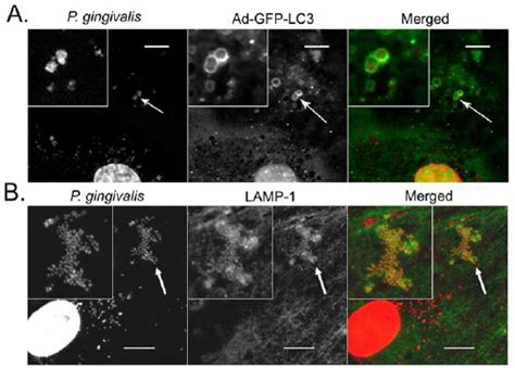 Representative microscopic images of P. gingivalis strain W83 within ... 