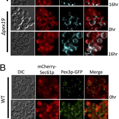 Pex P Localization In Wt And Pex Cells Fluorescence Microscopy