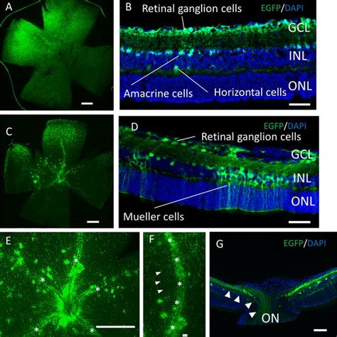 Immunostaining Of Each Retinal Cell Type Of Aav Dj Intravitreally