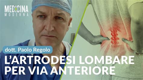 Artrodesi Lombare Per Via Anteriore Dott Paolo Regolo Youtube