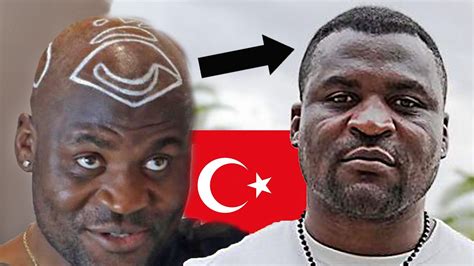 Francis Ngannou S Hair Transplant In Turkey With Now Hair Time Youtube