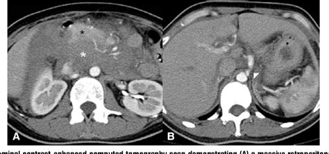 Figure From Visual Diagnosis In Emergency Medicine An Unusual Case Of