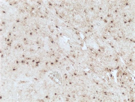 Siglec 3 CD33 Antibody 996810 Unconjugated MAB11371 Novus