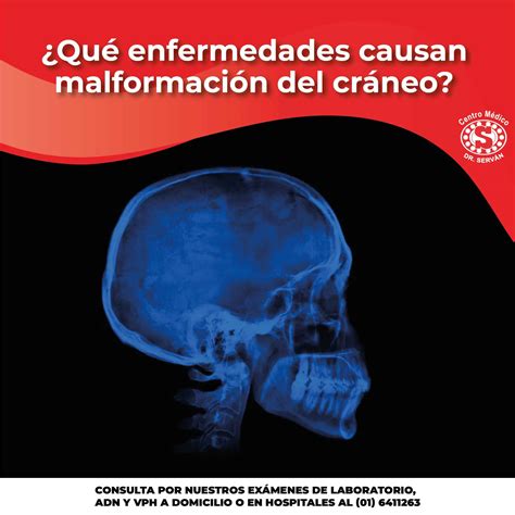 ¿qué Enfermedades Causan Malformación Del Cráneo Centro Médico Dr