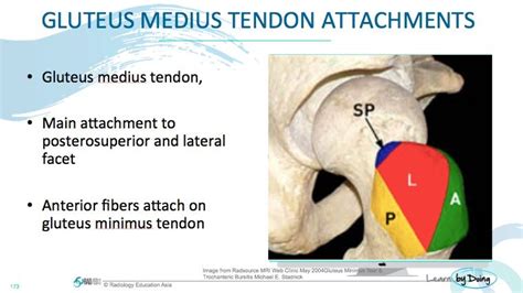 Mri Hip Gluteal Tendon Anatomy Radedasia