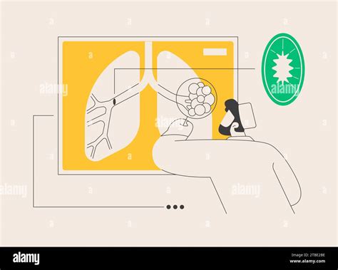 Chronic Obstructive Pulmonary Disease Abstract Concept Vector