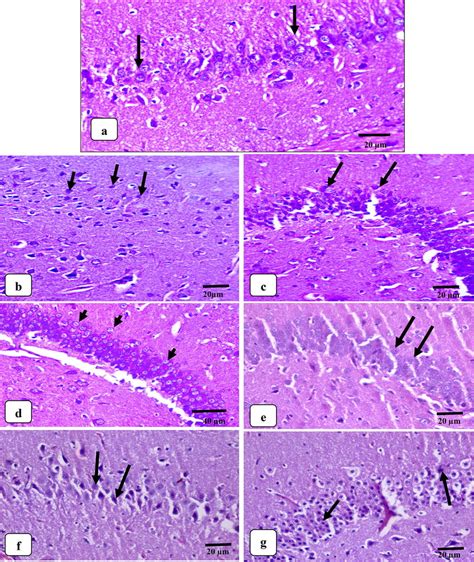 Photomicrograph Hande Of The Hippocampus Region Of Control Mice