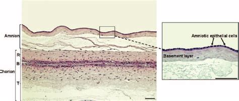 Histology of amnion and chorion membranes in human amniotic membranes ...